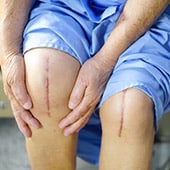 stem cell therapy knee surgery